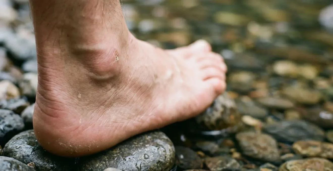 Gros plan sur des pieds en fin de journée de randonnée montrant les effets du gonflement